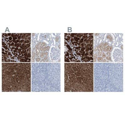Immunohistochemistry-Paraffin: Regucalcin Antibody [NBP1-80849]