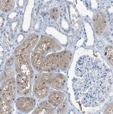 Immunohistochemistry-Paraffin: Regucalcin Antibody [NBP1-80849]