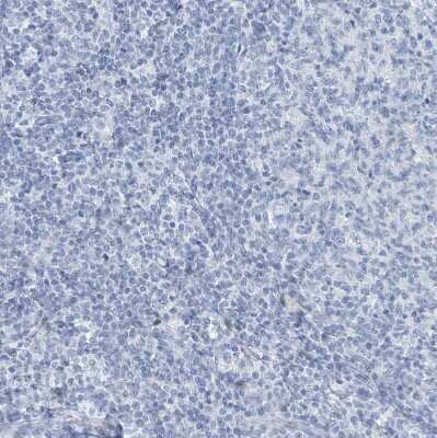 Immunohistochemistry-Paraffin: Regucalcin Antibody [NBP1-80849]