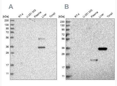 Western Blot: Regucalcin Antibody [NBP1-80850]