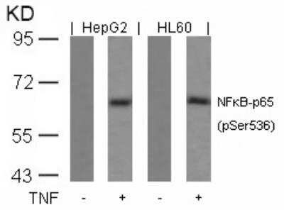 Western Blot: RelA/NFkB p65 [p Ser536] Antibody [NB100-82088]