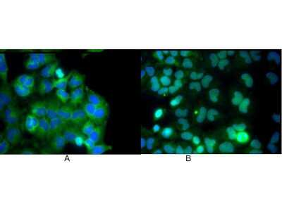 Immunocytochemistry/ Immunofluorescence: RelA/NFkB p65 Antibody (27F9.G4) [NBP1-77815]