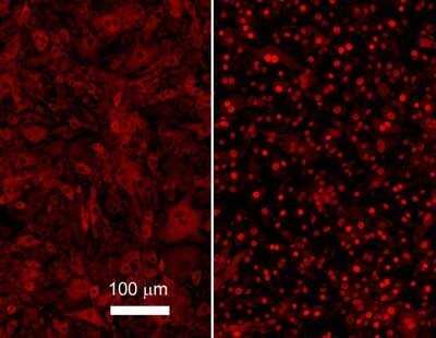 Immunocytochemistry/ Immunofluorescence: RelA/NFkB p65 Antibody (27F9.G4) [NBP1-77815]