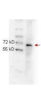 Western Blot: RelA/NFkB p65 Antibody (27F9.G4) [NBP1-77815]