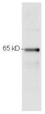 Western Blot: RelA/NFkB p65 Antibody (27F9.G4) [NBP1-77815]