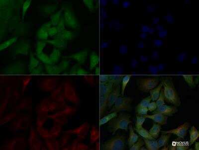 Immunocytochemistry/ Immunofluorescence: RelA/NFkB p65 Antibody [NB100-56502]