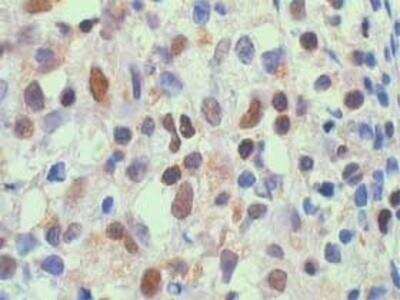 Immunohistochemistry-Paraffin: RelA/NFkB p65 Antibody [NB100-2176]