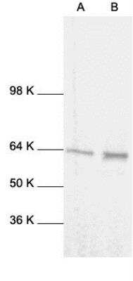 Western Blot: RelA/NFkB p65 Antibody [NB100-2176]