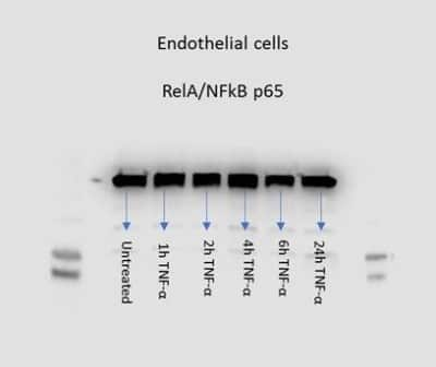 Western Blot: RelA/NFkB p65 Antibody [NB100-2176]