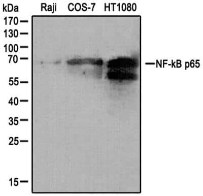 Western Blot: RelA/NFkB p65 Antibody [NB100-56502]