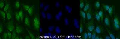 Immunocytochemistry/ Immunofluorescence: RelA/NFkB p65 NLS Antibody - BSA Free [NBP2-24541]