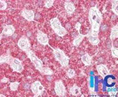 Immunohistochemistry-Paraffin: RelA/NFkB p65 NLS Antibody - BSA Free [NBP2-24541]