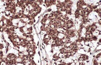 Immunohistochemistry-Paraffin: RelB Antibody [NBP2-20123]