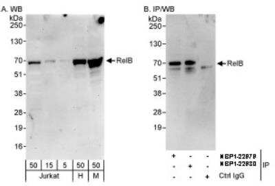 Western Blot: RelB Antibody [NBP1-22980]