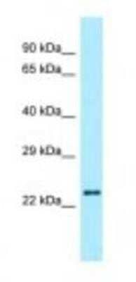 Western Blot: Relaxin-2 Antibody [NBP1-98451]