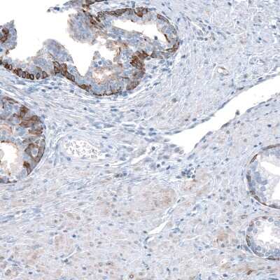 Immunohistochemistry-Paraffin: Relaxin R1/LGR7 Antibody [NBP1-89585]