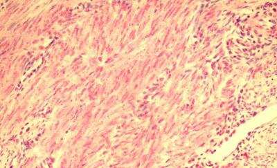 Immunohistochemistry-Paraffin: Relaxin R2/LGR8 Antibody - BSA Free [NLS4753]