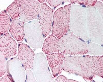 Immunohistochemistry-Paraffin: Relaxin R2/LGR8 Antibody - BSA Free [NLS4754]