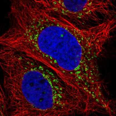 Immunocytochemistry/ Immunofluorescence: DEC-205/CD205 Antibody [NBP2-58339]