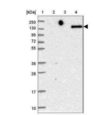 Western Blot: DEC-205/CD205 Antibody [NBP2-48926]