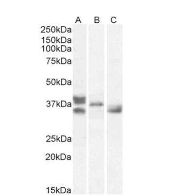 Western Blot: Renalase Antibody [NB100-1493]