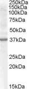 Western Blot: Renalase Antibody [NB100-93435]