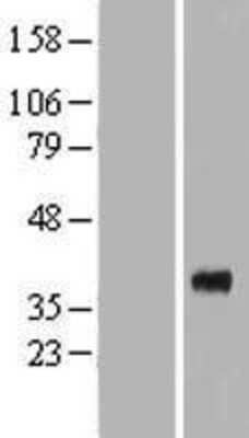 Western Blot: Renalase Overexpression Lysate [NBP2-06817]