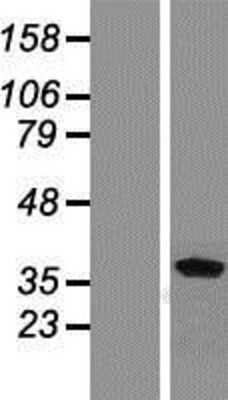 Western Blot: Renalase Overexpression Lysate [NBP2-10608]