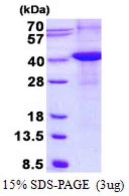 SDS-PAGE: Recombinant Human Renalase His Protein [NBP2-23407]