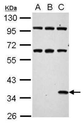 Western Blot: Renilla Luciferase Antibody [NBP2-42915]