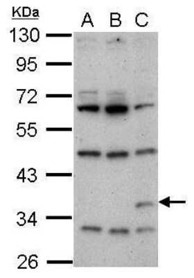 Western Blot: Renilla Luciferase Antibody [NBP2-42916]