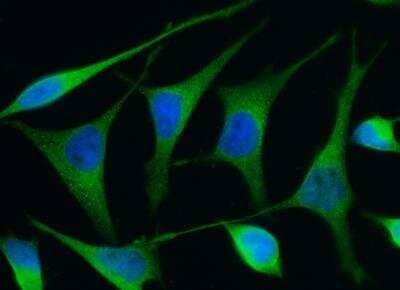 Immunocytochemistry/ Immunofluorescence: Renin Antibody (009) [NBP2-89723]