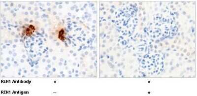 Immunohistochemistry-Paraffin: Renin Antibody (1) [NBP2-90510]