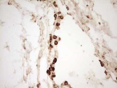 Immunohistochemistry: Renin Antibody (OTI2F10) [NBP2-45552]