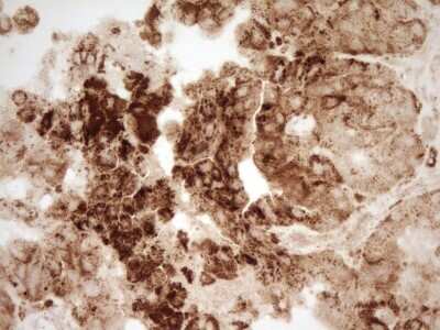 Immunohistochemistry: Renin Antibody (OTI2F10) [NBP2-45552]