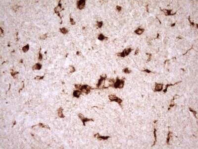 Immunohistochemistry: Renin Antibody (OTI2F10) [NBP2-45552]