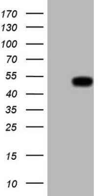 Western Blot: Renin Antibody (OTI2F10) [NBP2-45552]