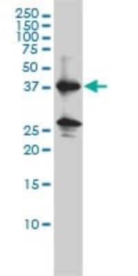 Western Blot: Renin Antibody (2H2) [H00005972-M01]