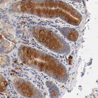 Immunohistochemistry: Renin Antibody [NBP1-87484]