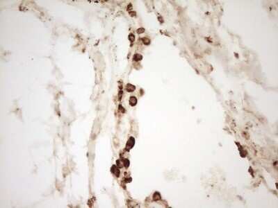 Immunohistochemistry: Renin Antibody (OTI2F10) - Azide and BSA Free [NBP2-73851]