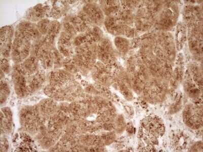 Immunohistochemistry: Renin Antibody (OTI2F10) - Azide and BSA Free [NBP2-73851]