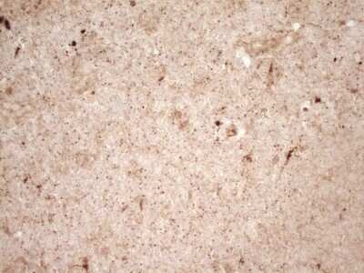 Immunohistochemistry: Renin Antibody (OTI2F10) - Azide and BSA Free [NBP2-73851]