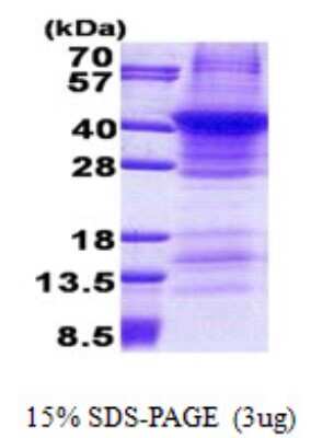 SDS-PAGE: Recombinant Human Renin His Protein [NBP2-23408]