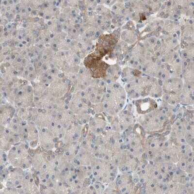 Immunohistochemistry-Paraffin: Renin R Antibody [NBP1-90820]