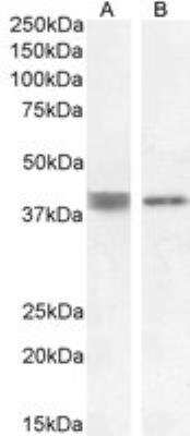 Western Blot: Renin R Antibody [NB100-1318]