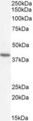 Western Blot: Renin R Antibody [NB100-1318]