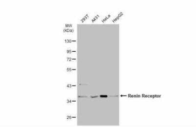 Western Blot: Renin R Antibody [NBP1-33605]