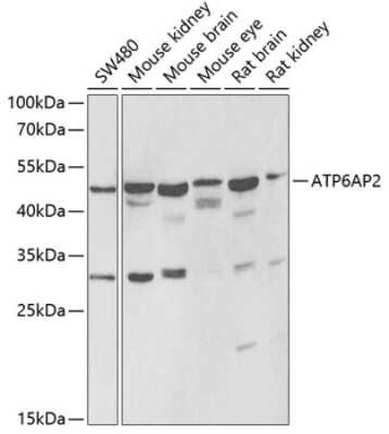 Western Blot: Renin R AntibodyBSA Free [NBP2-94053]