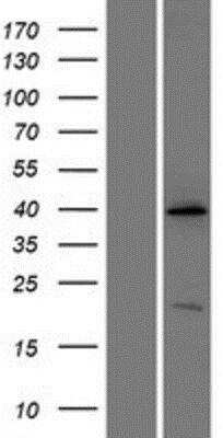 Western Blot: Renin R Overexpression Lysate [NBL1-07832]