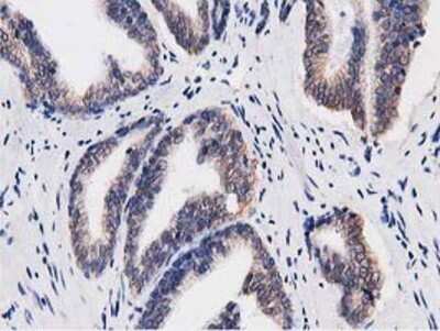 Immunohistochemistry: Replication Termination Factor 2 Antibody (OTI1E8) - Azide and BSA Free [NBP2-71934]